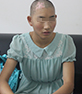 白癜风人群